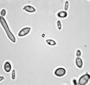 Brettanomyces bruxellensis